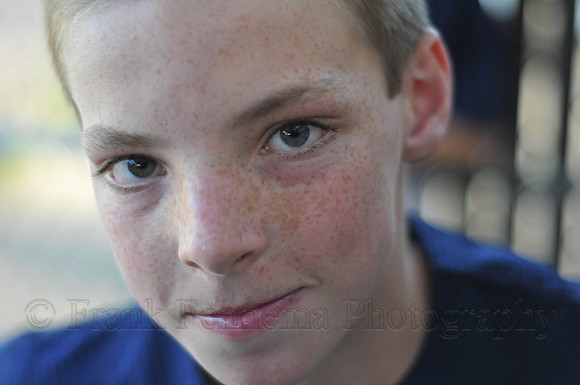 FGF_7135